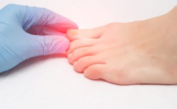 Cate ceva despre afectiunile unghiilor