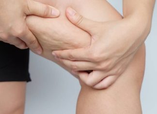 Cele mai bune creme anticelulitice