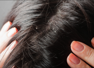 Matreata poate fi controlata!