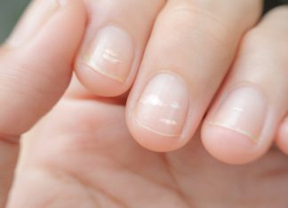 Sfaturi pentru albirea unghiilor