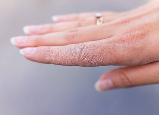 Piele uscata, ce e de facut?