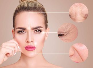 Scapa de riduri in mod natural