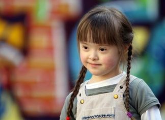 Ce inseamna de fapt Sindromul Down