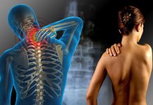 Sindromul fibromialgiei