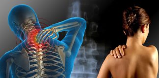 Sindromul fibromialgiei