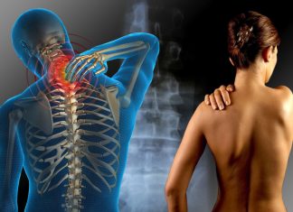 Sindromul fibromialgiei