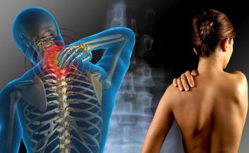 Sindromul fibromialgiei