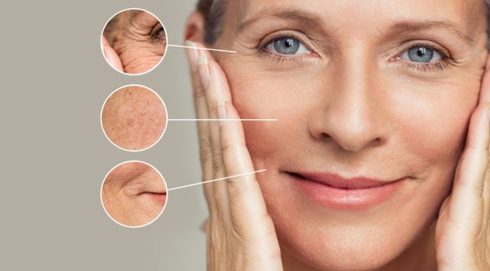 Tratamentul cu Botox pentru ochi