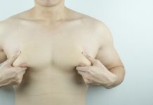 Ginecomastie bilaterală: cauze, diagnostic și opțiuni de tratament